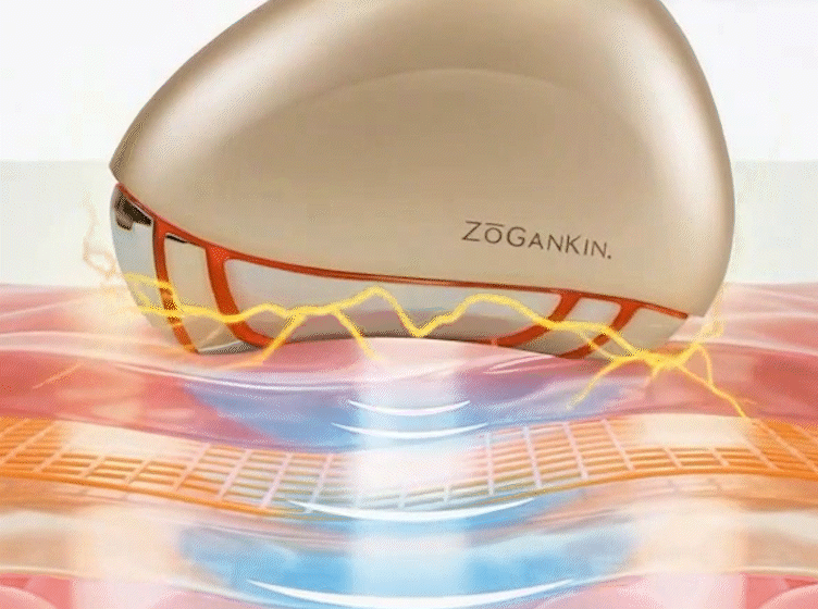 ZOGANKIN ゾーガンキン カッサ