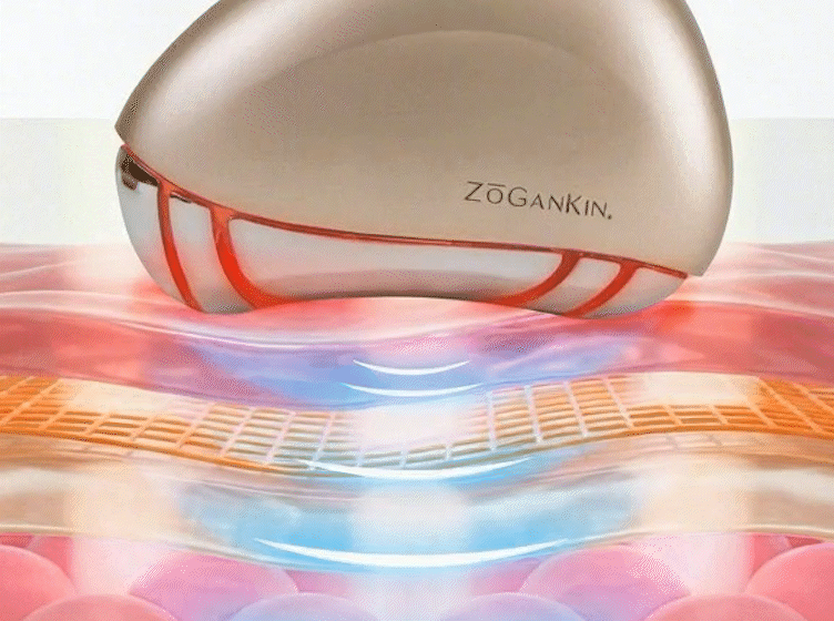 ZOGANKIN ゾーガンキン カッサ