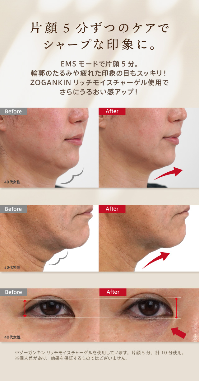 ZOGANKIN ゾーガンキン カッサ